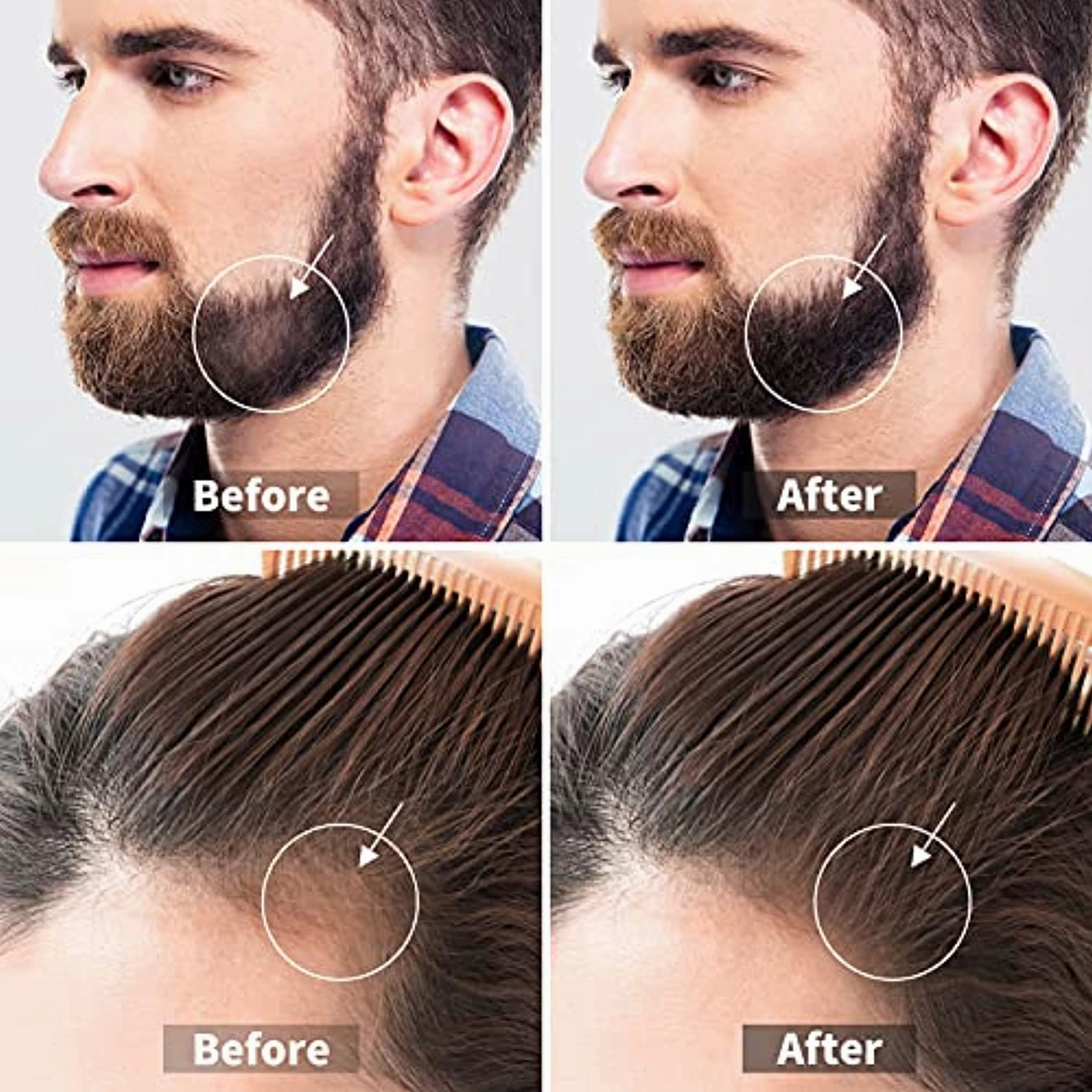 Derma Roller Microneedle Roller for Face Body Beard Hair Growth, 540 Titanium Micro Needles Roller for Home Use