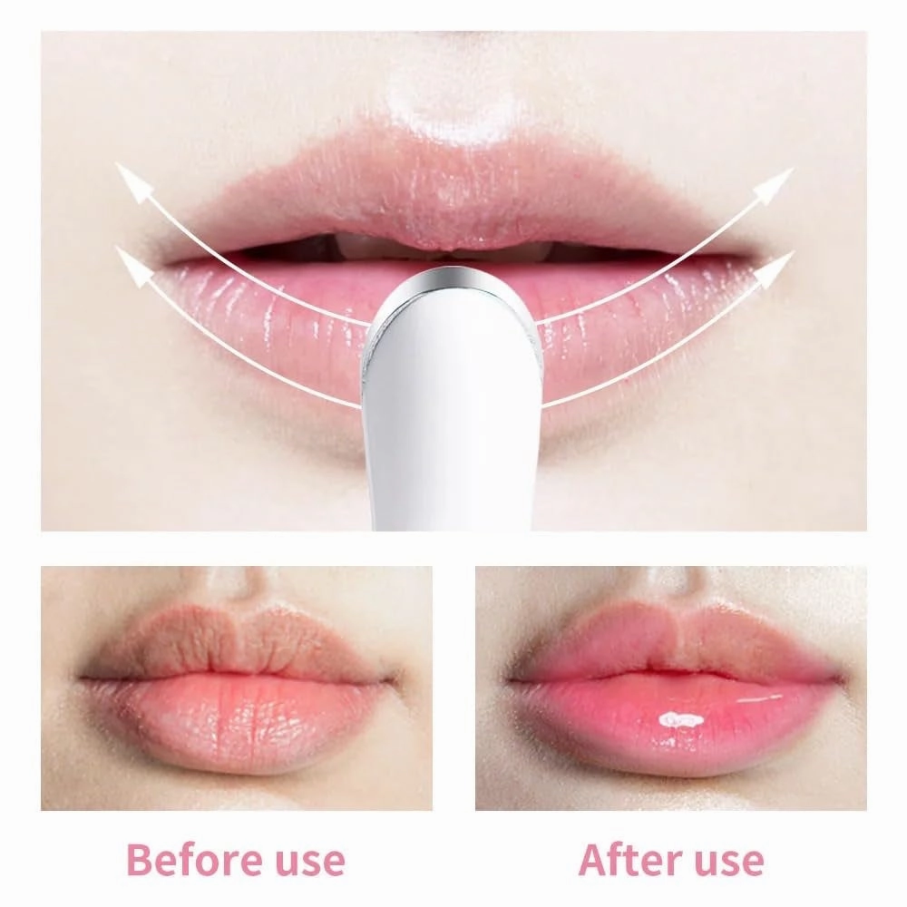 Electric Lip Plumper Lip Massager Tool Electric Lip Pen Device Lip Wrinkle Remover Natural Lip Plumper Tool Lip Filler Lip Suction Lip Enhancer Machine Lip Enhancer Lip Balm Infusor (White)