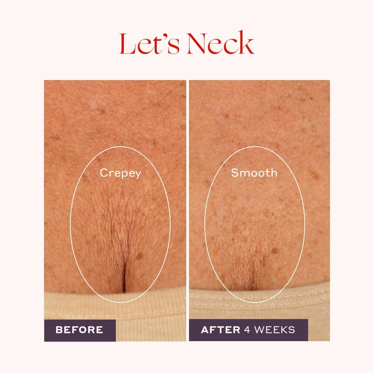 Let'S Neck Firming Serum - Roll on Neck Creams for Tightening and Firming - Daily Crepey Skin Treatment to Smooth Neck Wrinkles & Sagging Skin - Hydrate, Tighten and Lift (50Ml)